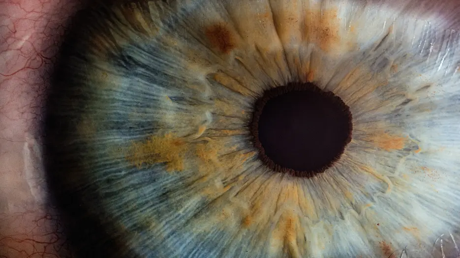 Auge