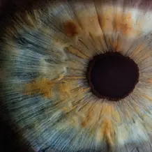 Auge